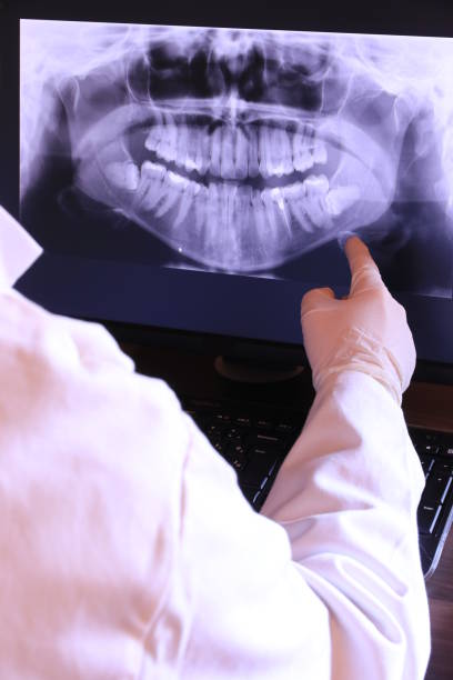 Best Emergency Root Canal Treatment in Airport, CA